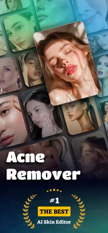 Acnefix screenshot 1
