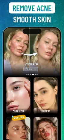 Acnefix screenshot 2